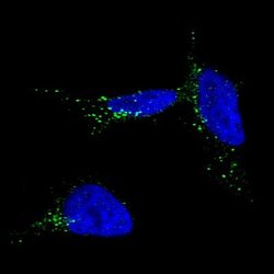 TYRP1 Antibody (CL4906), Novus Biologicals:Antibodies:Primary Antibodies